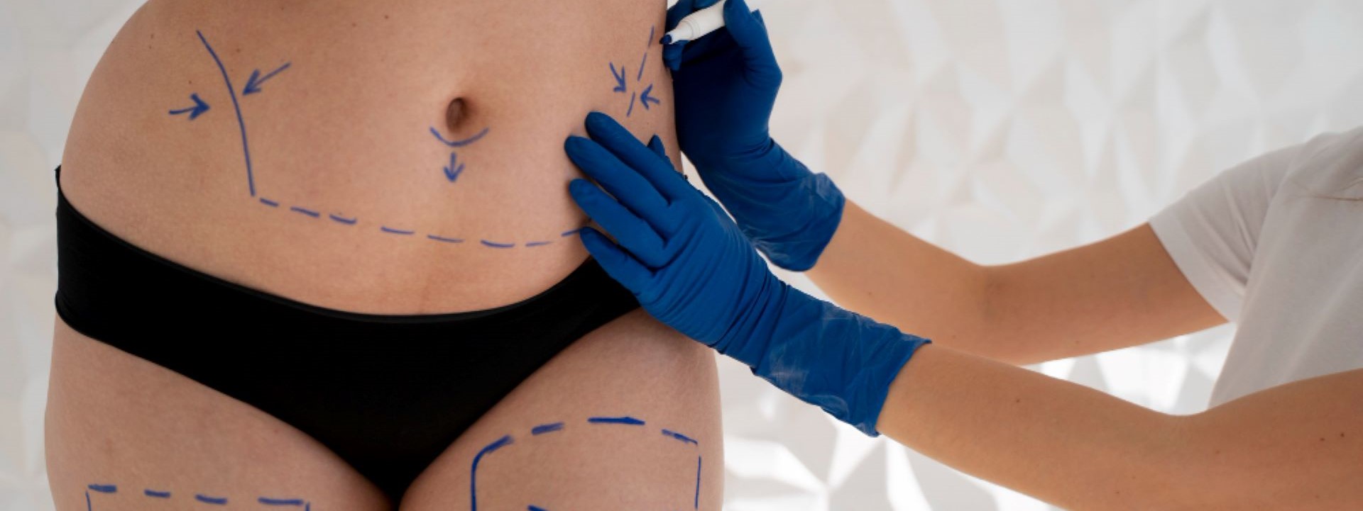 Liposuction Benefits