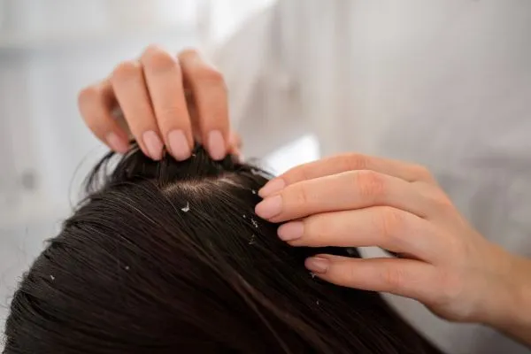   Dandruff Treatment vs Scalp Detox Therapy: Which One Do You Need?