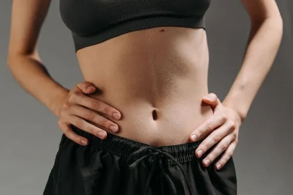 Diastasis Recti vs Belly Fat: What’s the Difference?