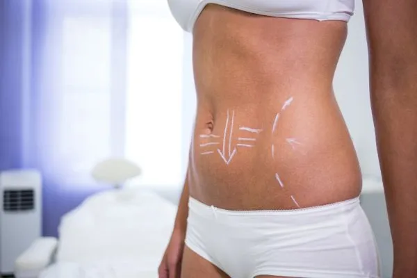  Liposuction Techniques Explained: Traditional, VASER & Hi-Def