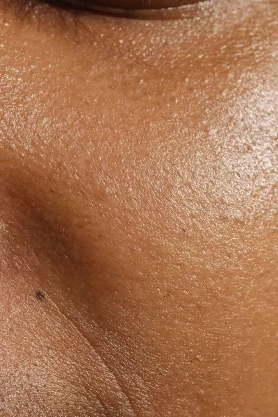 Why Does My Skin Texture Look Uneven? Common Causes & Treatments
